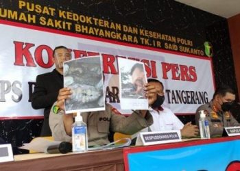Kondisi Gigi Patah Jadi Petunjuk Tim DVI Identifikasi 2 Jenazah Korban Kebakaran Lapas Tangerang